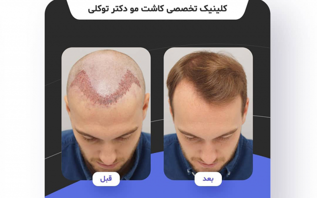 طراحی قالب پست و استوری اینستاگرام انجام بدم