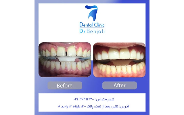 برای پست های اینستاگرام شما تمپلیت طراحی کنم