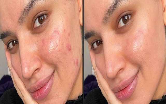 برای شما حذف شخص/اشیا ، حذف لوگو ، روتوش سبک و حذف بک گروند  انجام بدم.