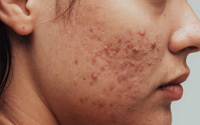تصاویر شما را روتوش و ویرایش بکنم