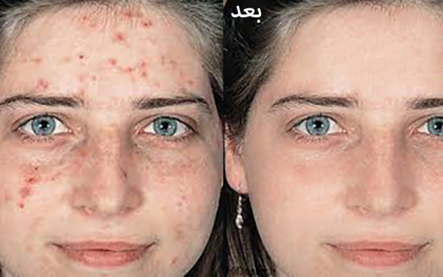 عکس شمارو روتوش و دوربری کنم