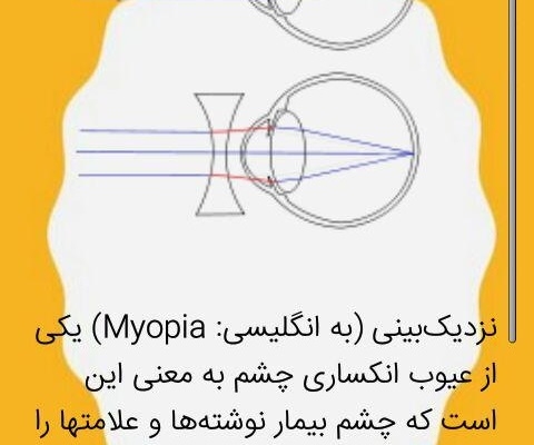 براتون یه اپلیکیشن اندرویید و یا IOS بسازم به صورت حرفه ای