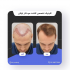 طراحی قالب پست و استوری اینستاگرام انجام بدم