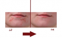 عکس-ویرایش-روتوش