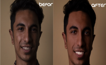 عکس-راکامل-روتوش