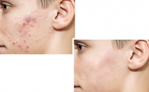 روتوش-ویرایش-عکس-بدهم