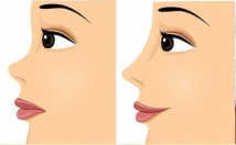 طراحی-پست-استوری-اینستاگرام